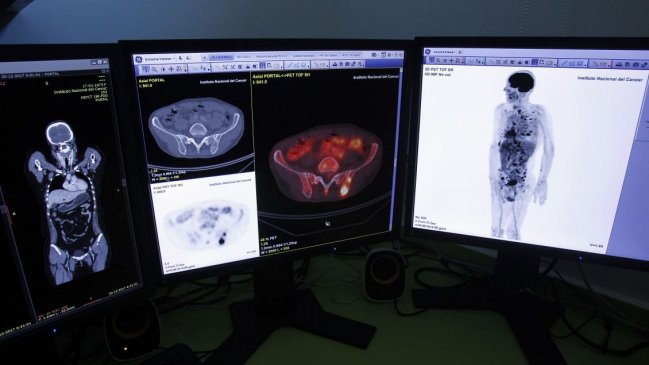 Casos de cáncer en América pueden subir un 60 por ciento para 2040 si no hay medidas