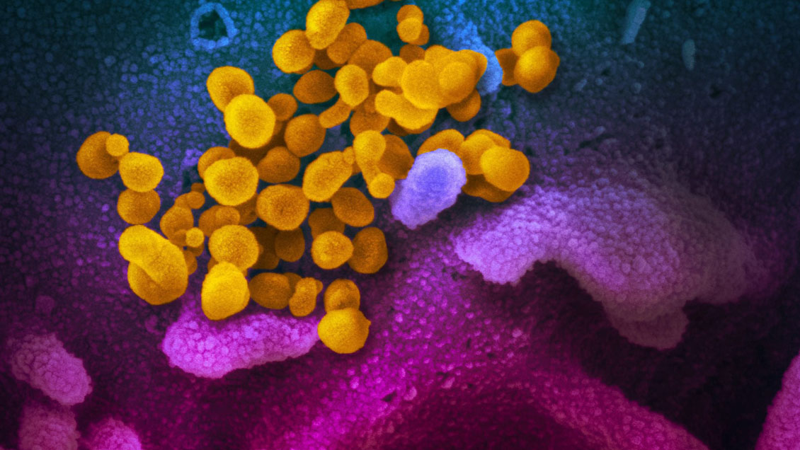 Estudios científicos concluyen que la pandemia del Covid comenzó en el mercado Huanan en Wuhan