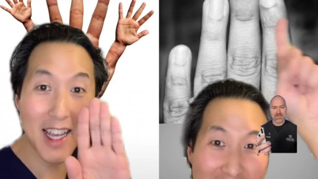   Médico en TikTok asegura que hay una relación entre los dedos y el tamaño del pene 