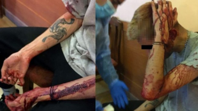 Movilh denunció ataque a jóvenes en restaurante de Providencia