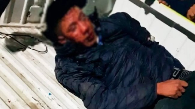 Vecinos propinaron brutal golpiza a motochorro en Argentina: Le cortaron dos dedos