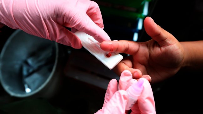  Científicos chilenos realizaron hallazgo que puede impulsar nuevas terapias contra el VIH  