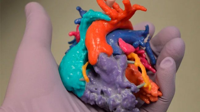La impresión 3D impulsa las cirugías cardiovascualares en el Hospital de Temuco