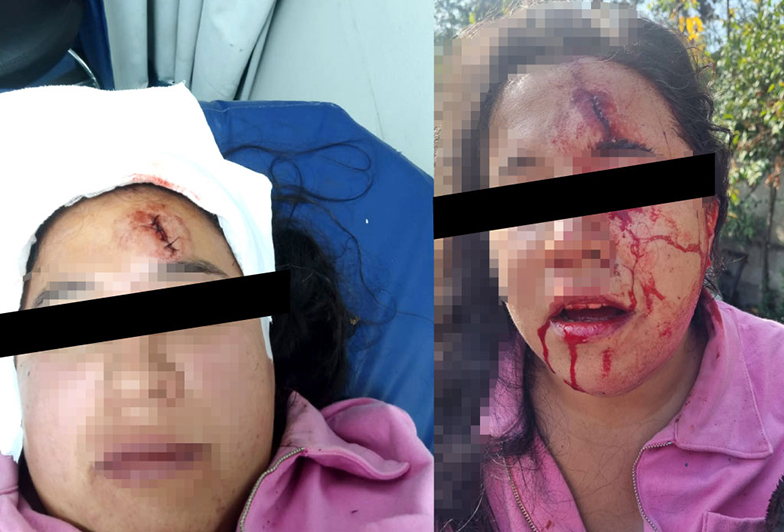 Imagen foto_00000002