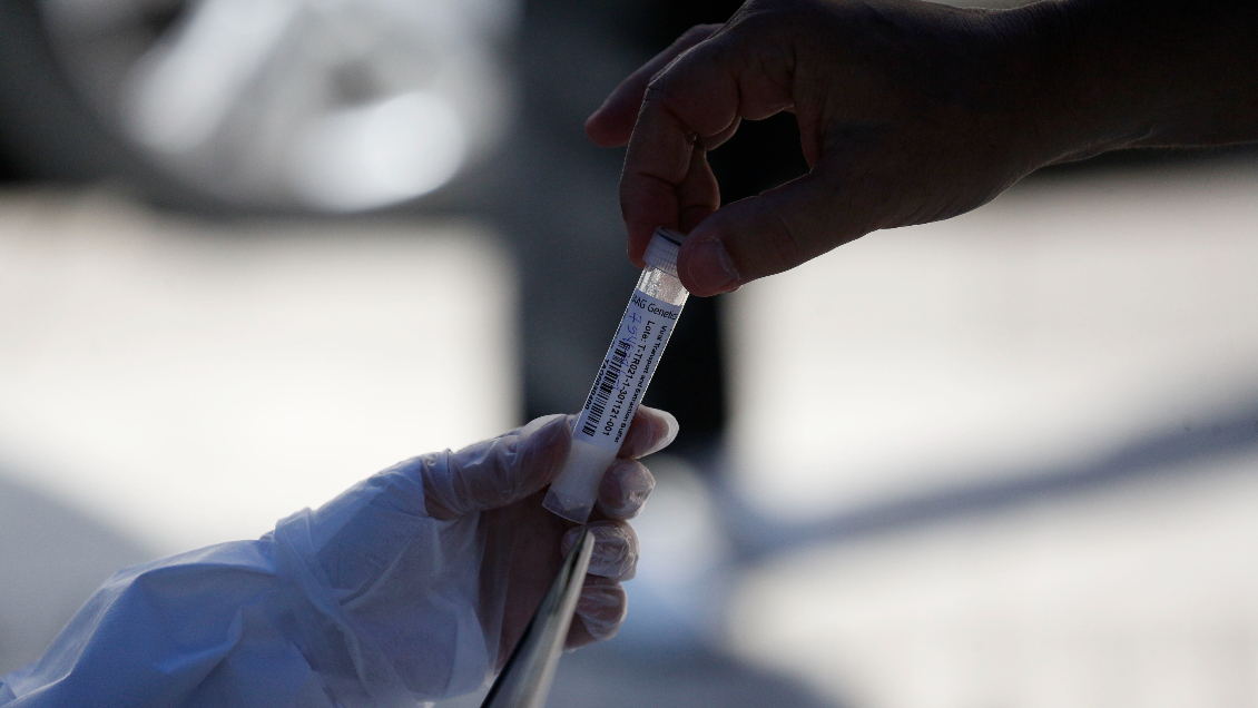 Chile reporta 9.322 casos de Covid-19, la cifra más alta desde mediados de marzo