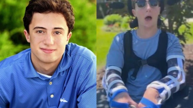 Joven fue obligado a beber alcohol desde un tubo en fiesta universitaria: Quedó ciego y paralítico