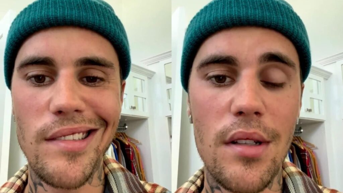 Justin Bieber cancela más conciertos debido a su enfermedad nerviosa