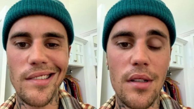 Justin Bieber cancela más conciertos debido a su enfermedad nerviosa