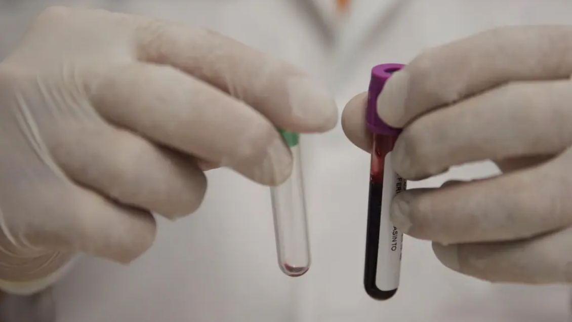 Científicos anuncian prometedores resultados en un tratamiento eficaz contra la leucemia