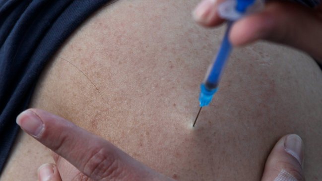 La EMA recomendó la vacuna Imvanex para la viruela del mono