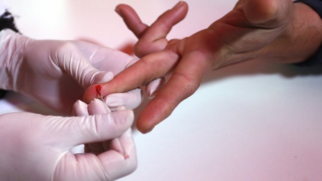  Inédito: Paciente lleva 15 años controlando el VIH sin ningún tipo de medicamento  