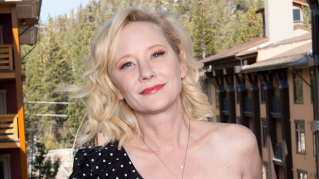 Actriz Anne Heche sufre graves quemaduras tras protagonizar accidente automovilístico