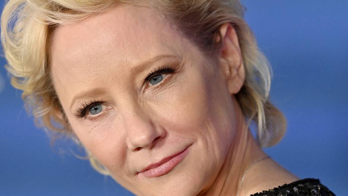 Forense confirmó la causa de muerte de Anne Heche