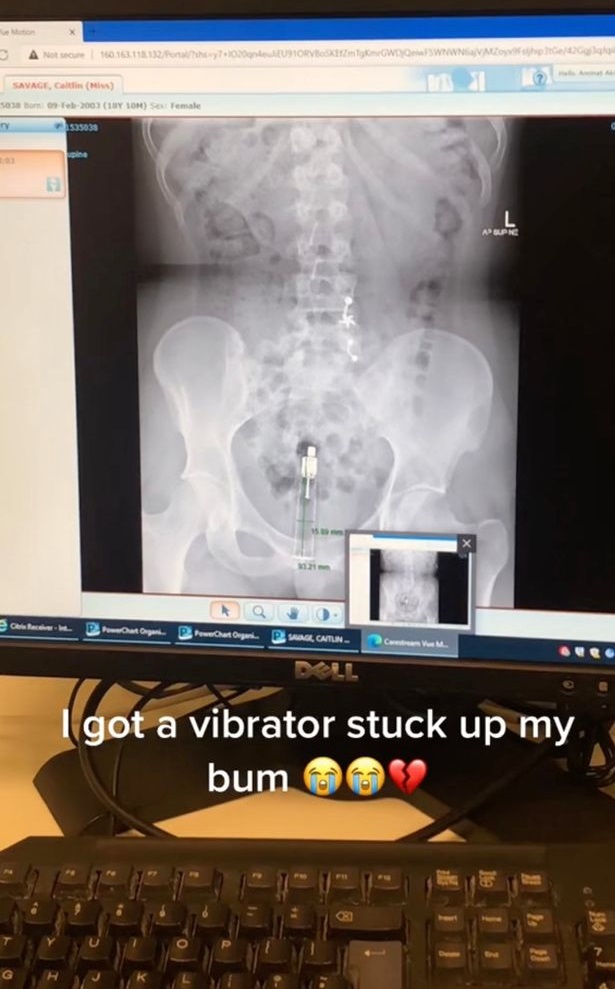 Imagen foto_00000002