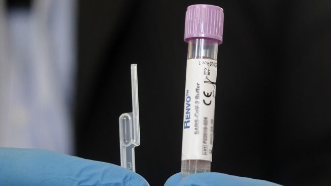 Casos diarios de Covid-19 vuelven a bajar de los 2.000