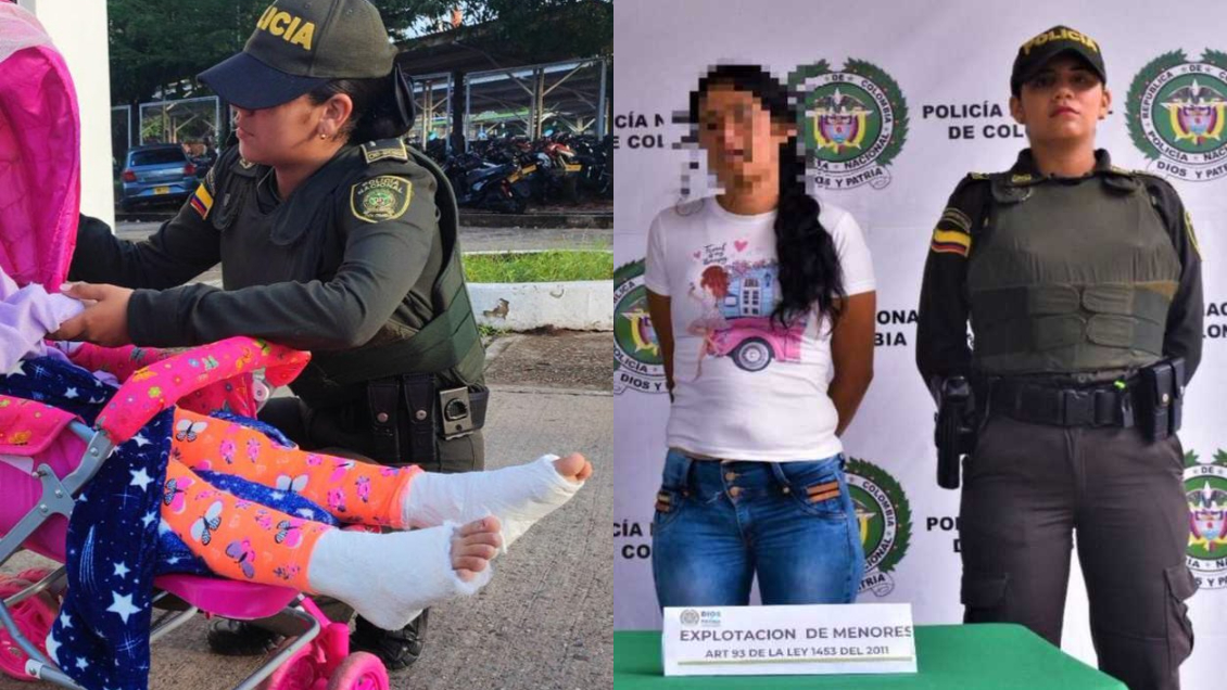 Detienen a mamá que enyesaba a su hija de siete años para pedir limosna