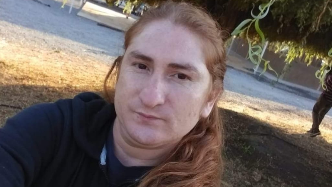 Movilh denuncia ataque homofóbico en Puente Alto: Víctima fue golpeada con llave francesa