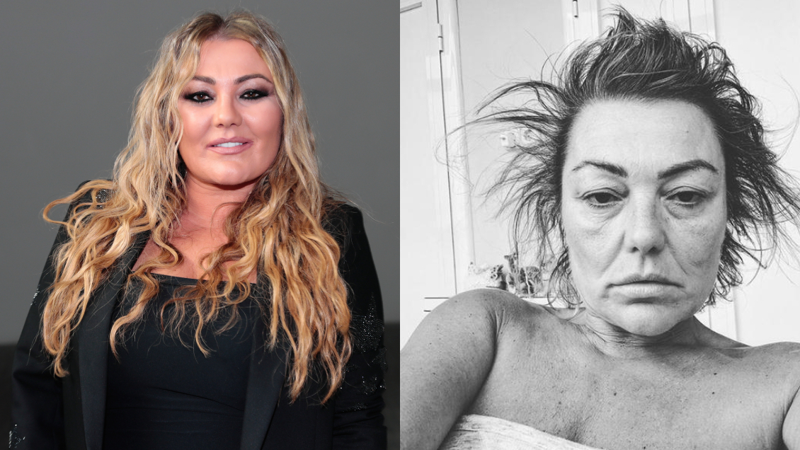 Hermana de Amaia Montero da detalles de su salud tras preocupante foto