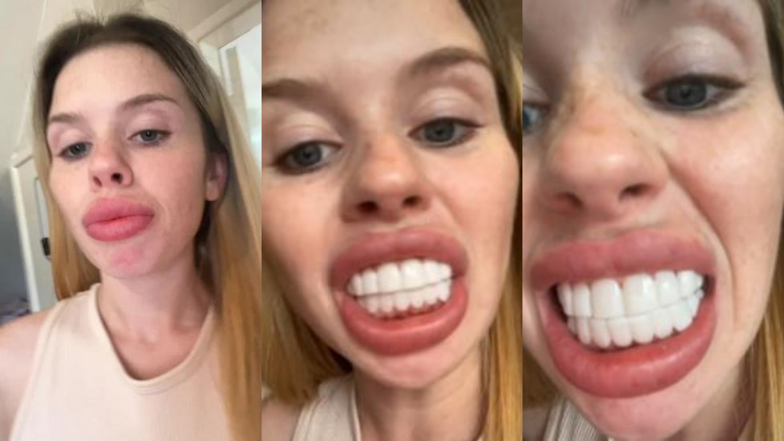 Joven gastó 200 mil pesos para tener la 