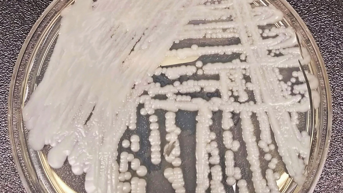 Argentina detecta dos casos del hongo Cándida auris, superresistente a fármacos