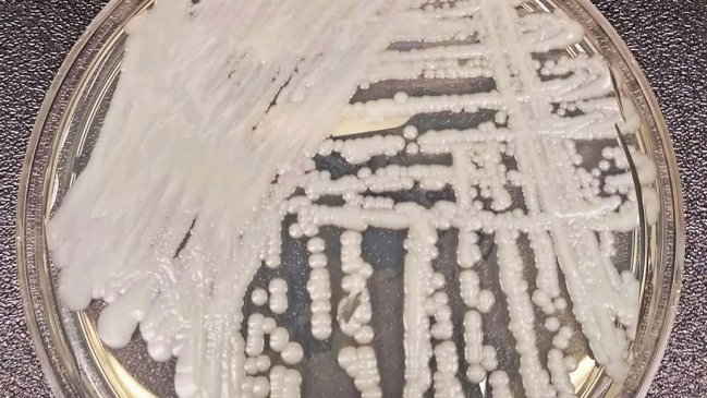 Argentina detecta dos casos del hongo Cándida auris, superresistente a fármacos