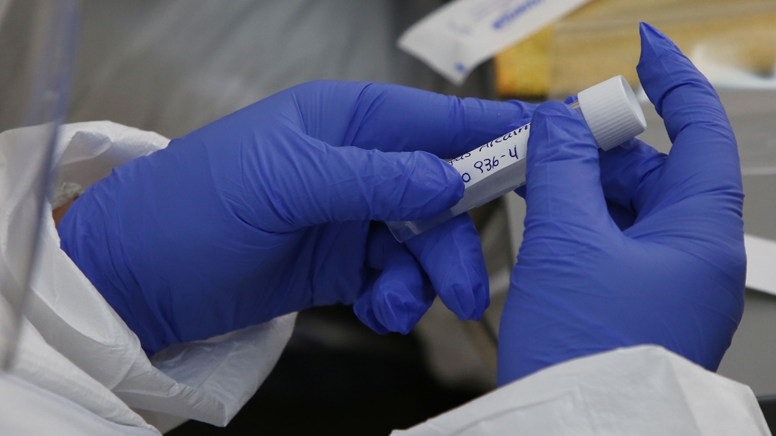 Covid-19: Minsal reportó 2.977 casos nuevos y una positividad de 15,1 por ciento