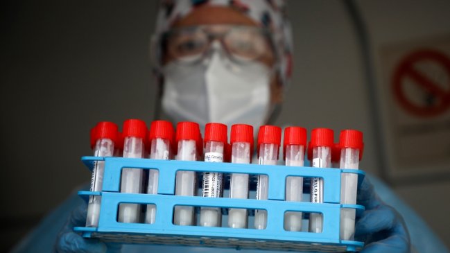 Estudio confirmó que los anticuerpos se mantienen 17 meses después de contagiarse de Covid