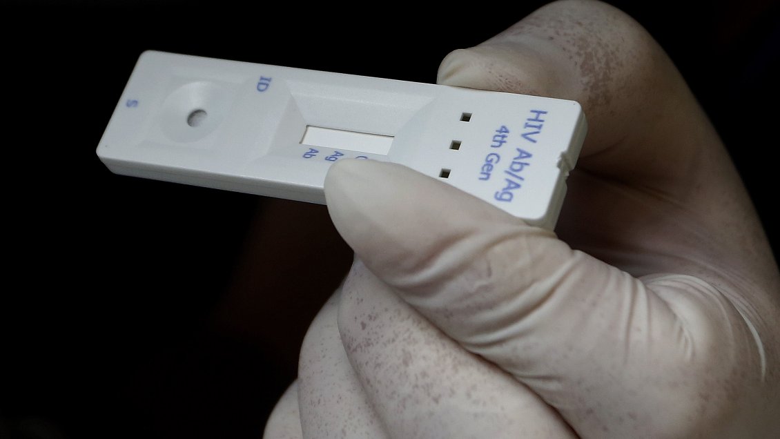 OMS alerta de subida de infecciones de VIH sin diagnosticar en región europea