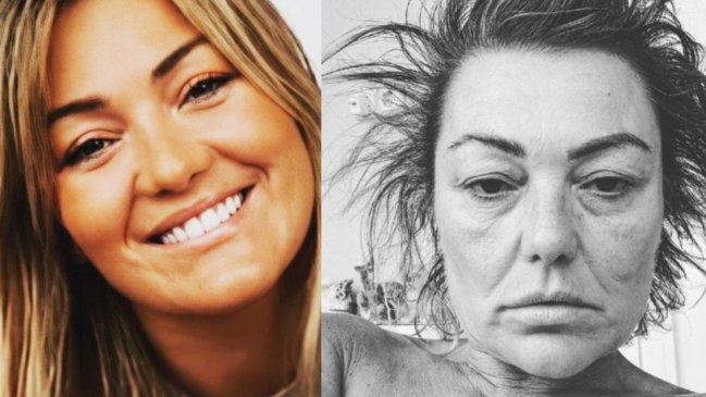 Amaia Montero publica su primera foto después de ser ingresada a la clínica