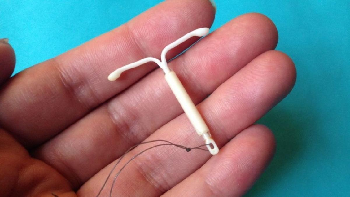 Corporación Miles denunció que Cesfam de Viña negó DIU a mujer 