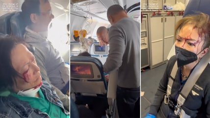 Pasajeros salieron disparados: 36 heridos tras turbulencias en vuelo hacia Hawaii