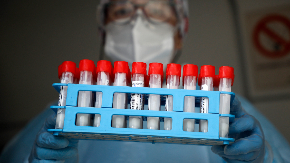 Reportan más de 2.000 casos diarios de Covid-19: Hay preocupación por nuevas variantes