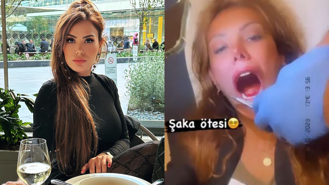 Demasiada pasión: Mujer terminó en urgencias luego que le arrancaran parte de su lengua en un beso