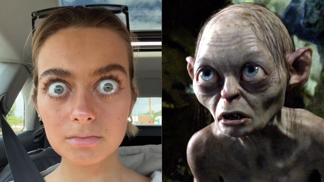 “Me llaman Gollum”: Joven causa furor en redes por sus enormes ojos