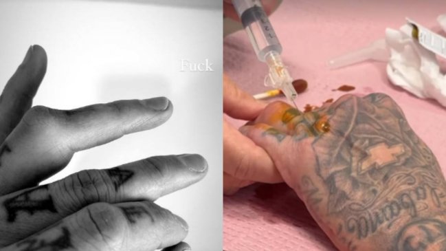 Travis Barker sufrió lesión en uno de sus dedos a un mes de la gira de Blink-182