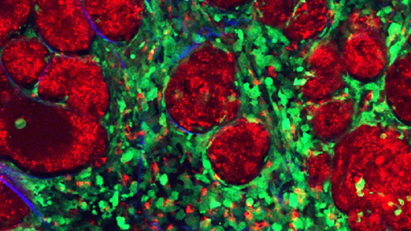 Científicos descubren por qué fracasan algunos compuestos antitumorales