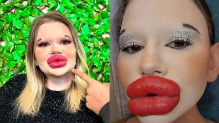   Mujer con los labios más grandes del mundo busca batir un nuevo récord con sus mejillas 
