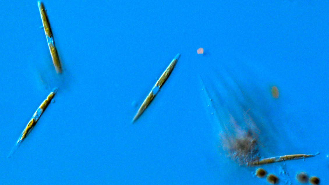 Detectan presencia desconocida de especies neurotóxicas en Magallanes