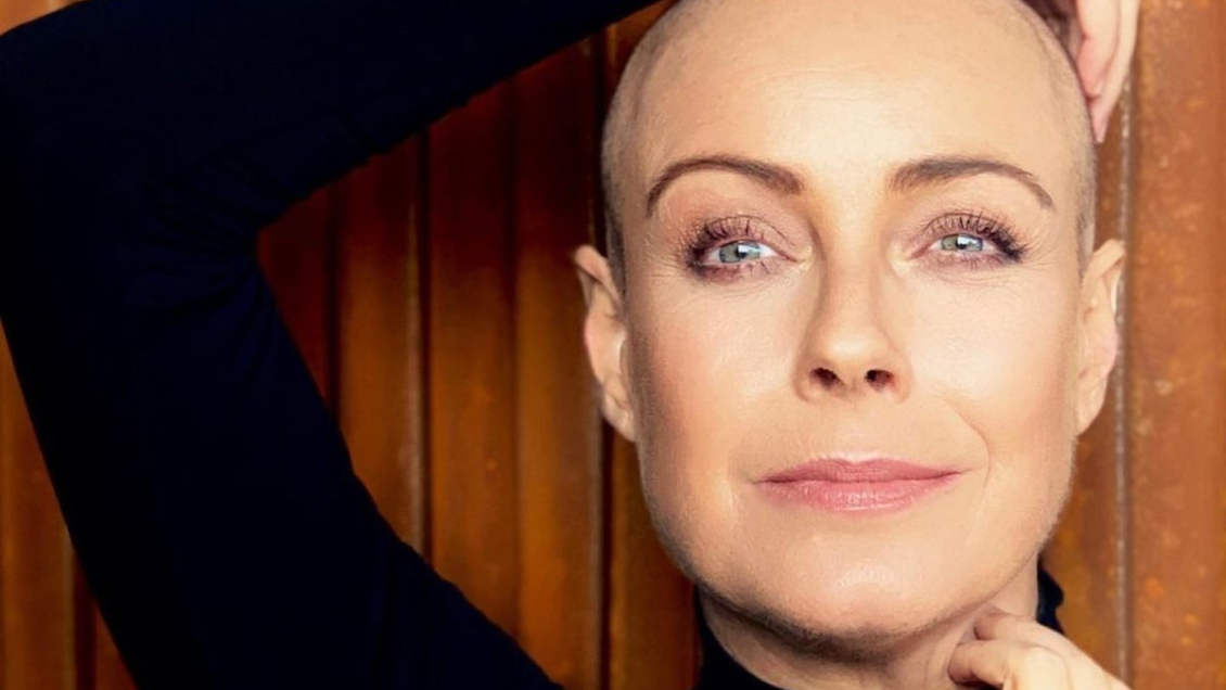 Periodista actualiza sobre estado de salud de Claudia Conserva