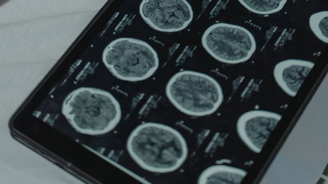 Científicos desarrollan batería implantable que mata células tumorales