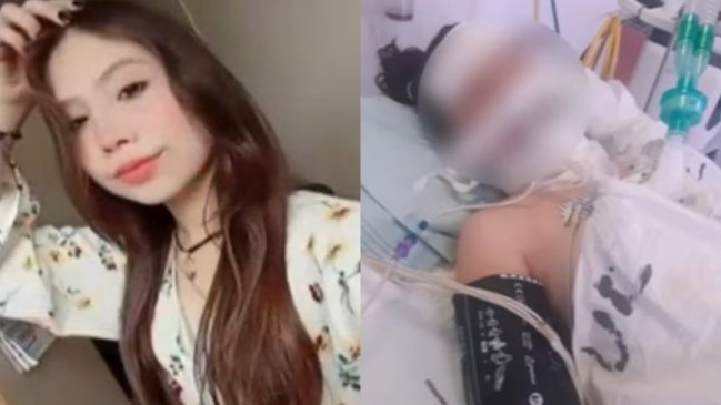 Joven de 20 años fue dentista a sacarse una muela y murió