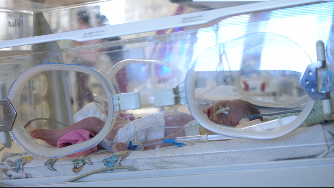 Nacimientos prematuros son la principal causa de mortalidad infantil en el mundo