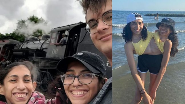 Siamesa que comparte pelvis con su hermana presentó a su pololo y explicó su relación