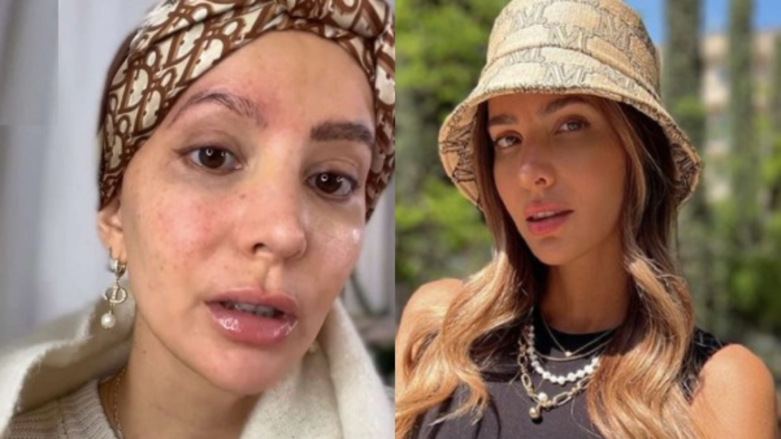 Aylén Milla detalla evolución de su cáncer y adelanta el próximo procedimiento quirúrgico que enfrentará