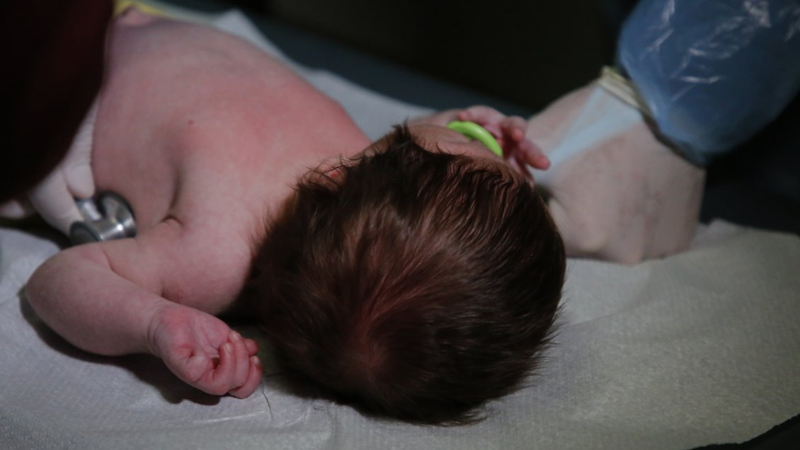 Anticuerpos monoclonales: El nuevo tratamiento que el Minsal analiza incorporar contra el virus sincicial