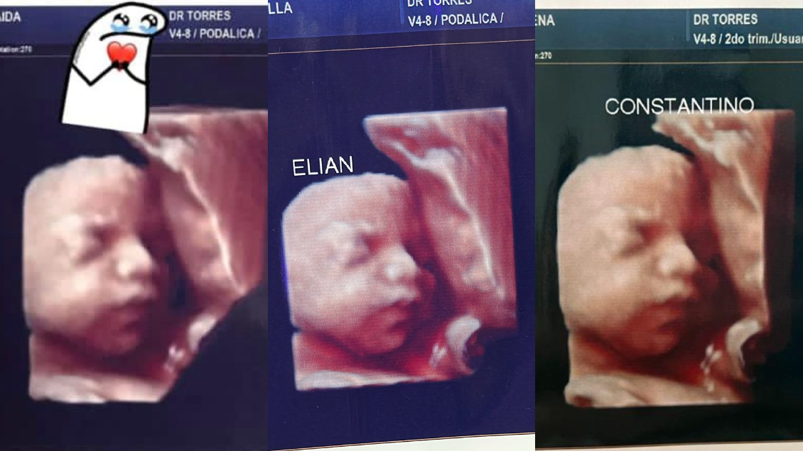 Embarazadas se hicieron una ecografía 