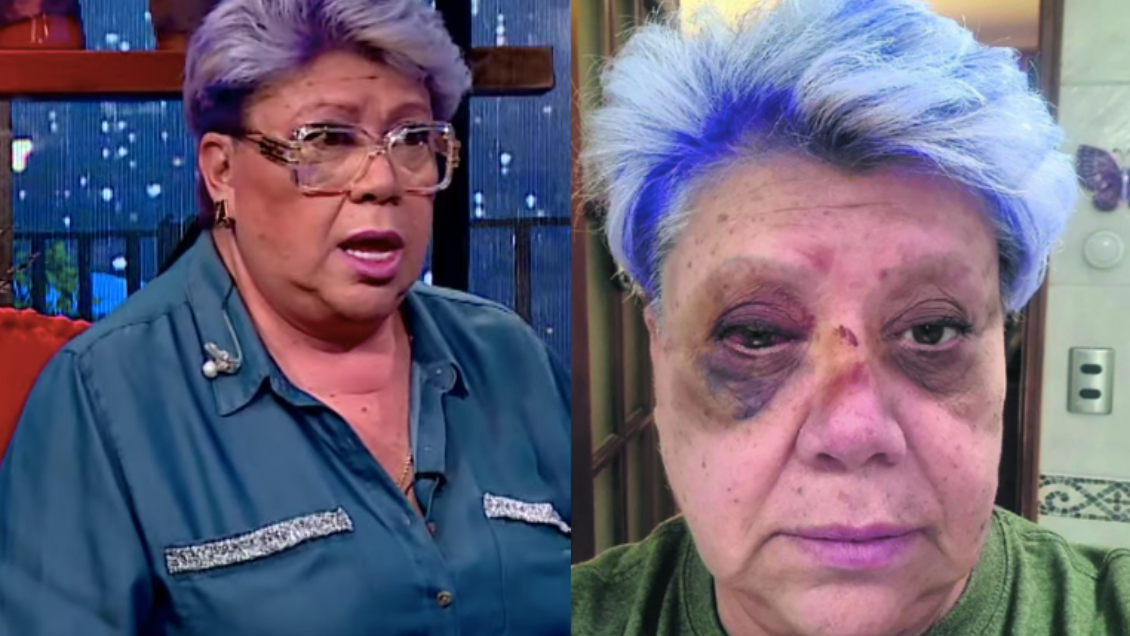 Patricia Maldonado detalla secuelas físicas y psicológicas a dos semanas de sufrir accidente automovilístico