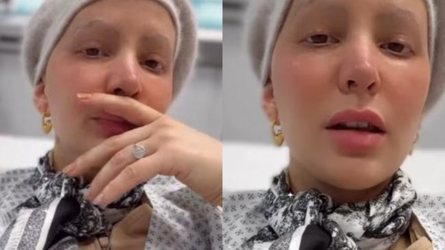  Aylén Milla se sometió a dolorosa operación contra el cáncer: 
