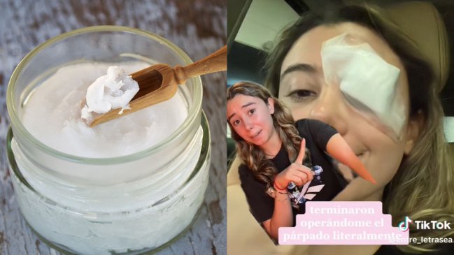 Joven terminó en hospital tras seguir consejo de belleza de TikTok