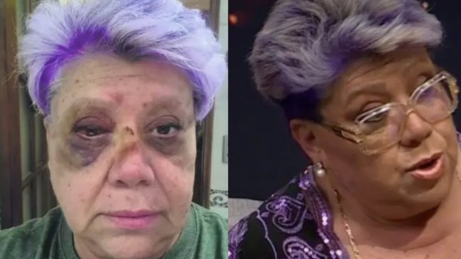 Patricia Maldonado reveló millonaria pérdida tras caótico accidente